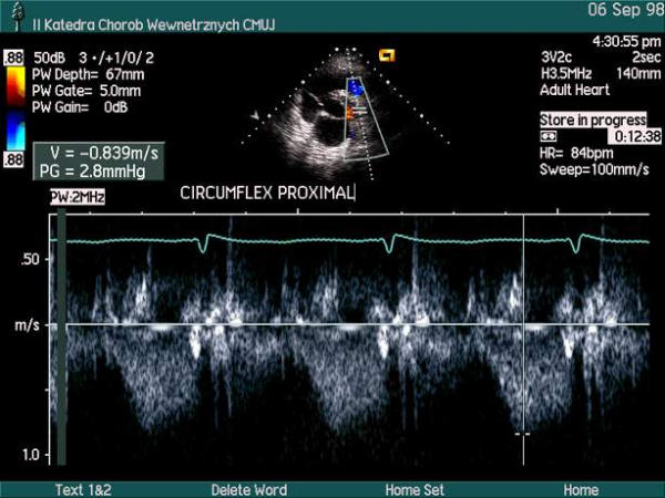 Figure 47