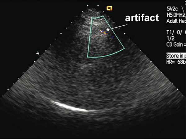 Figure 48