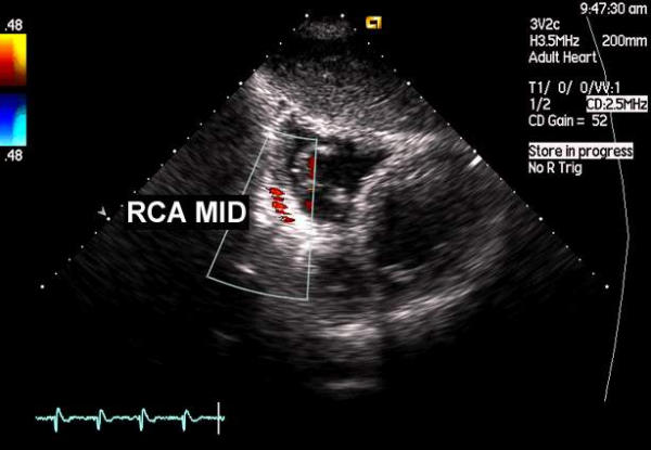 Figure 53