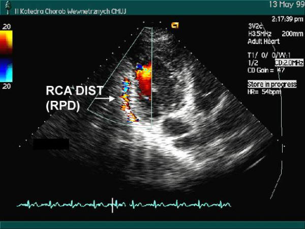 Figure 39