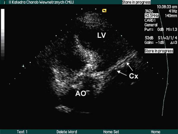 Figure 28