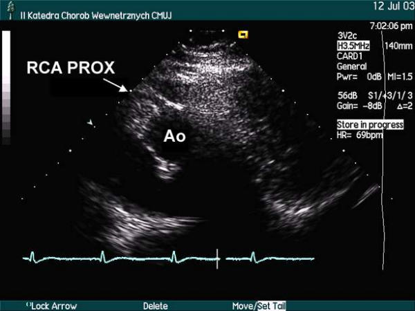 Figure 30