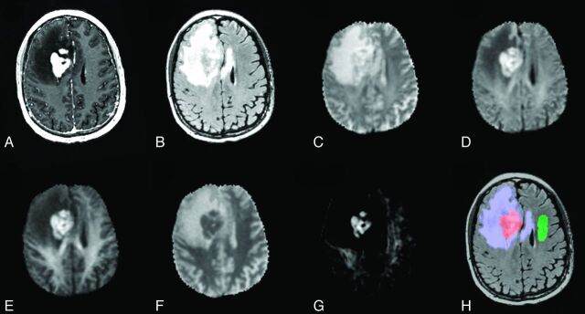 Fig 2.