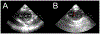 Figure 2: