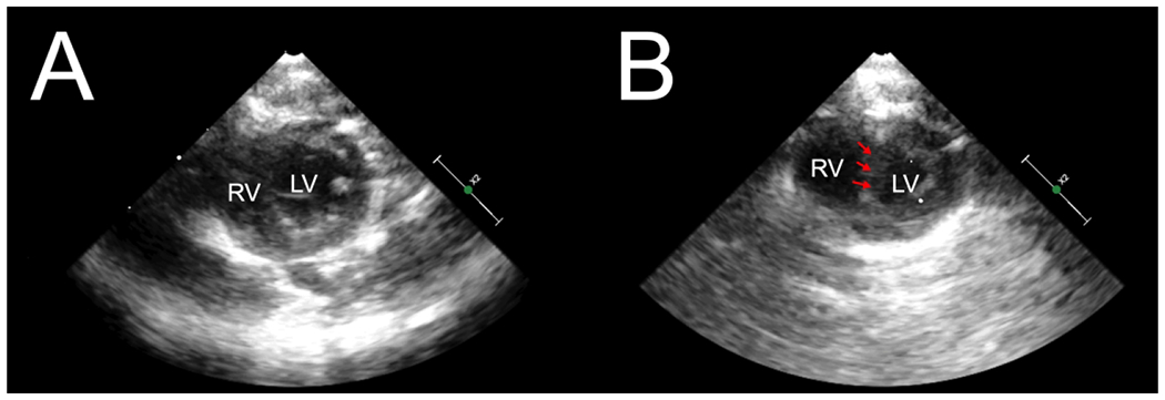 Figure 2: