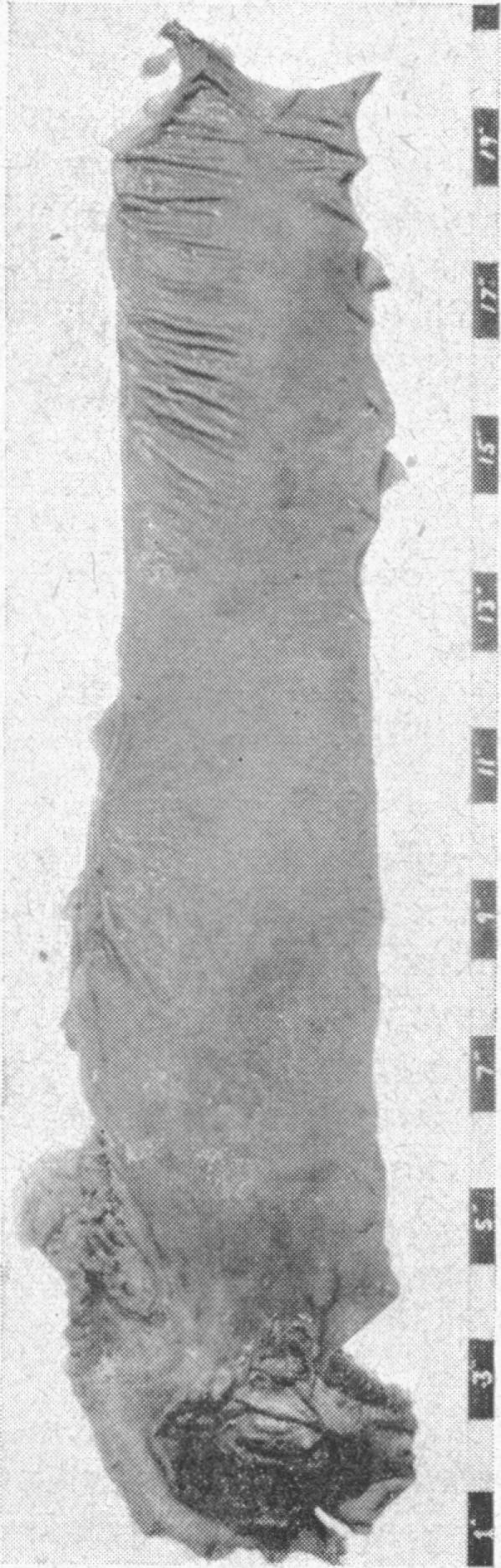 FIG. 9