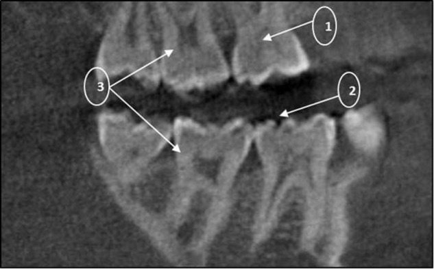 Fig. 3