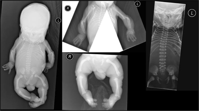 Fig. 1