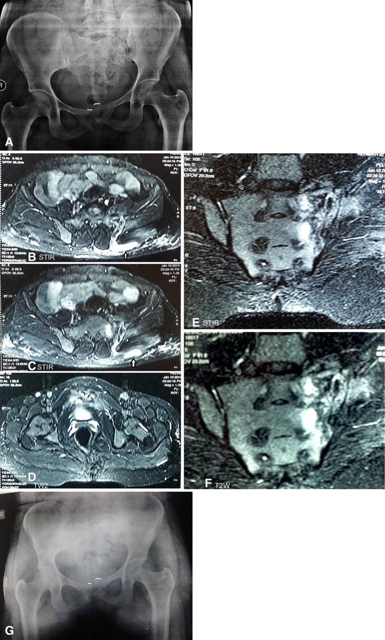 Fig. 3A–G