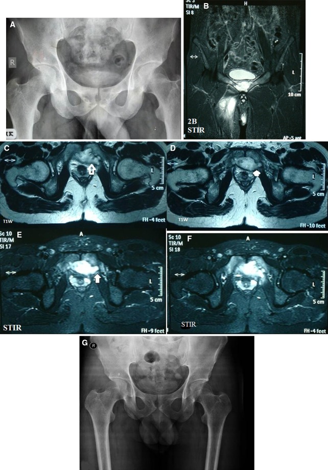 Fig. 2A–G