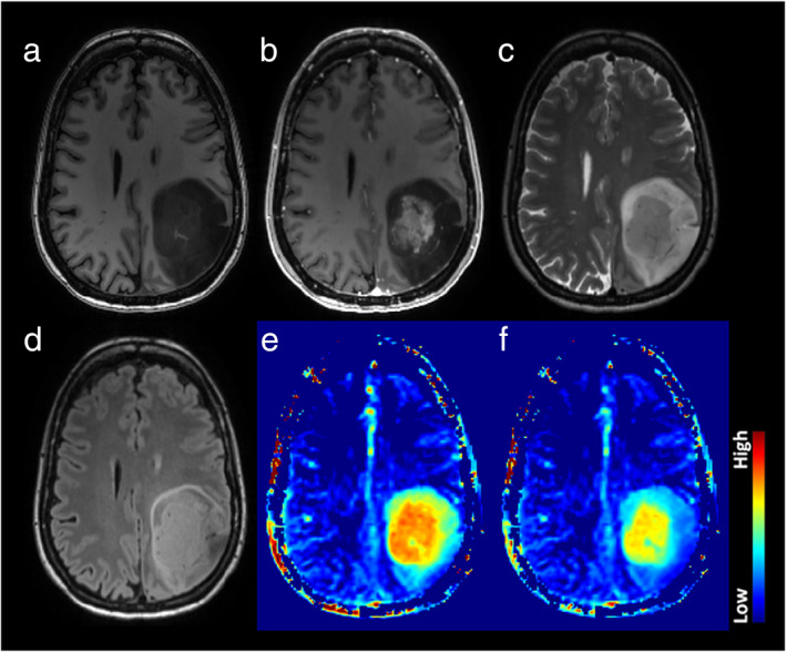 FIGURE 3