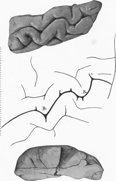 Fig. 12