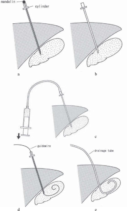 Fig. 1a–e