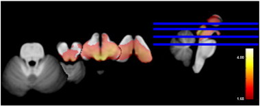 Fig. 2