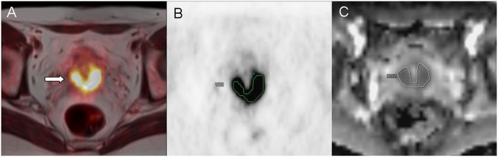 Fig 2