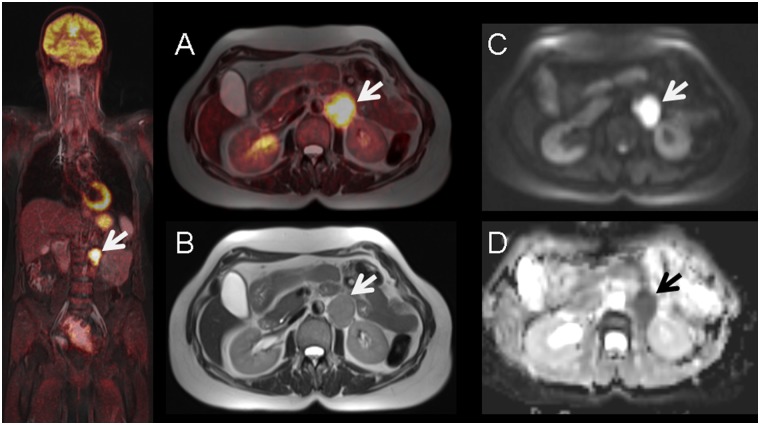 Fig 1