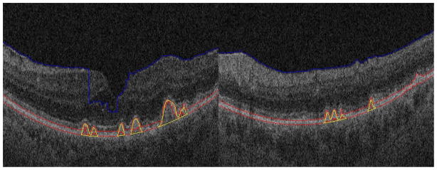 Fig. 12