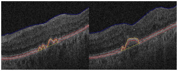 Fig. 9