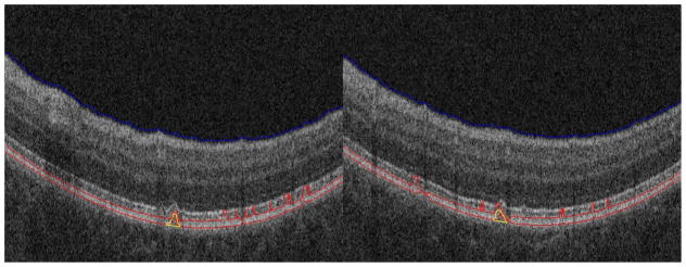 Fig. 11