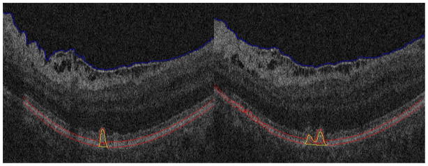 Fig. 10