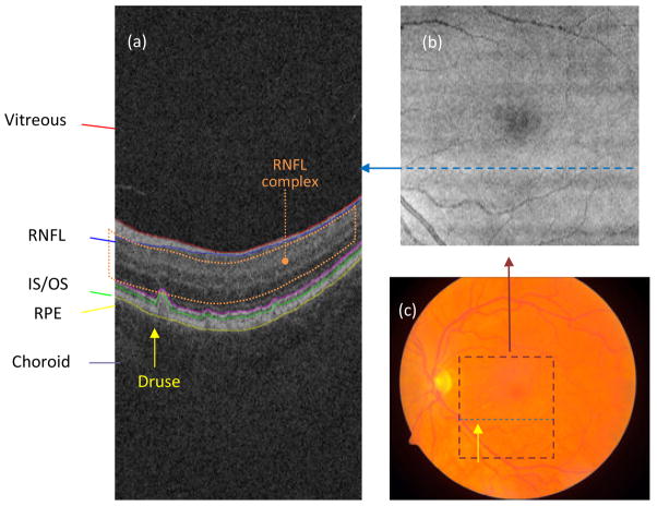 Fig. 1