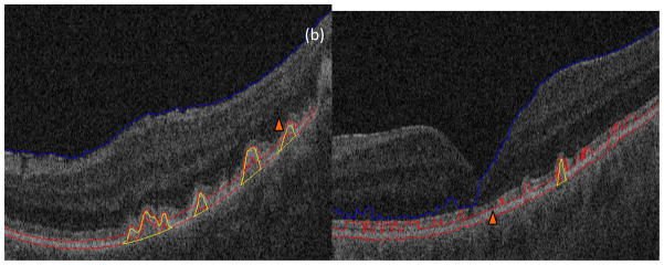 Fig. 13