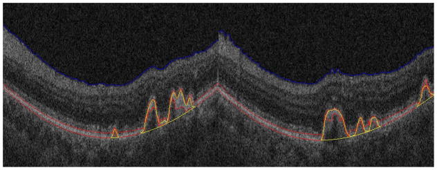 Fig. 12