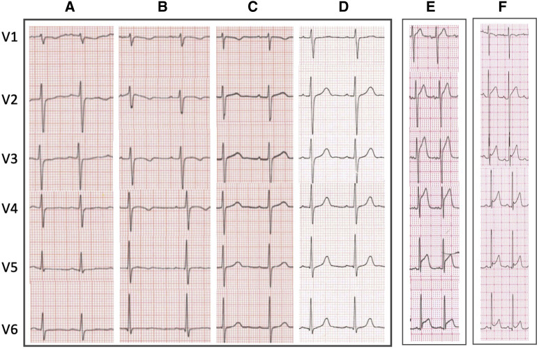 Figure 3