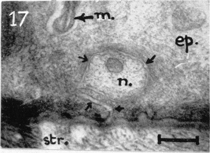 Fig. 17