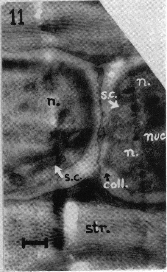 Fig. 11