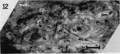 Fig. 12