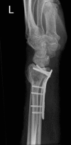 Figure 6