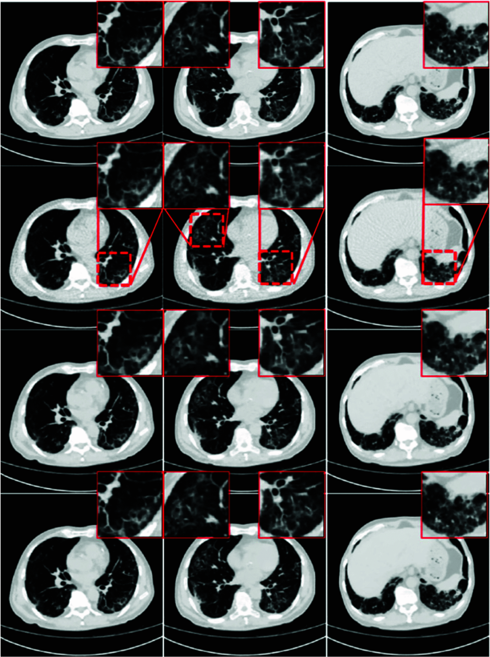 Fig. 15.