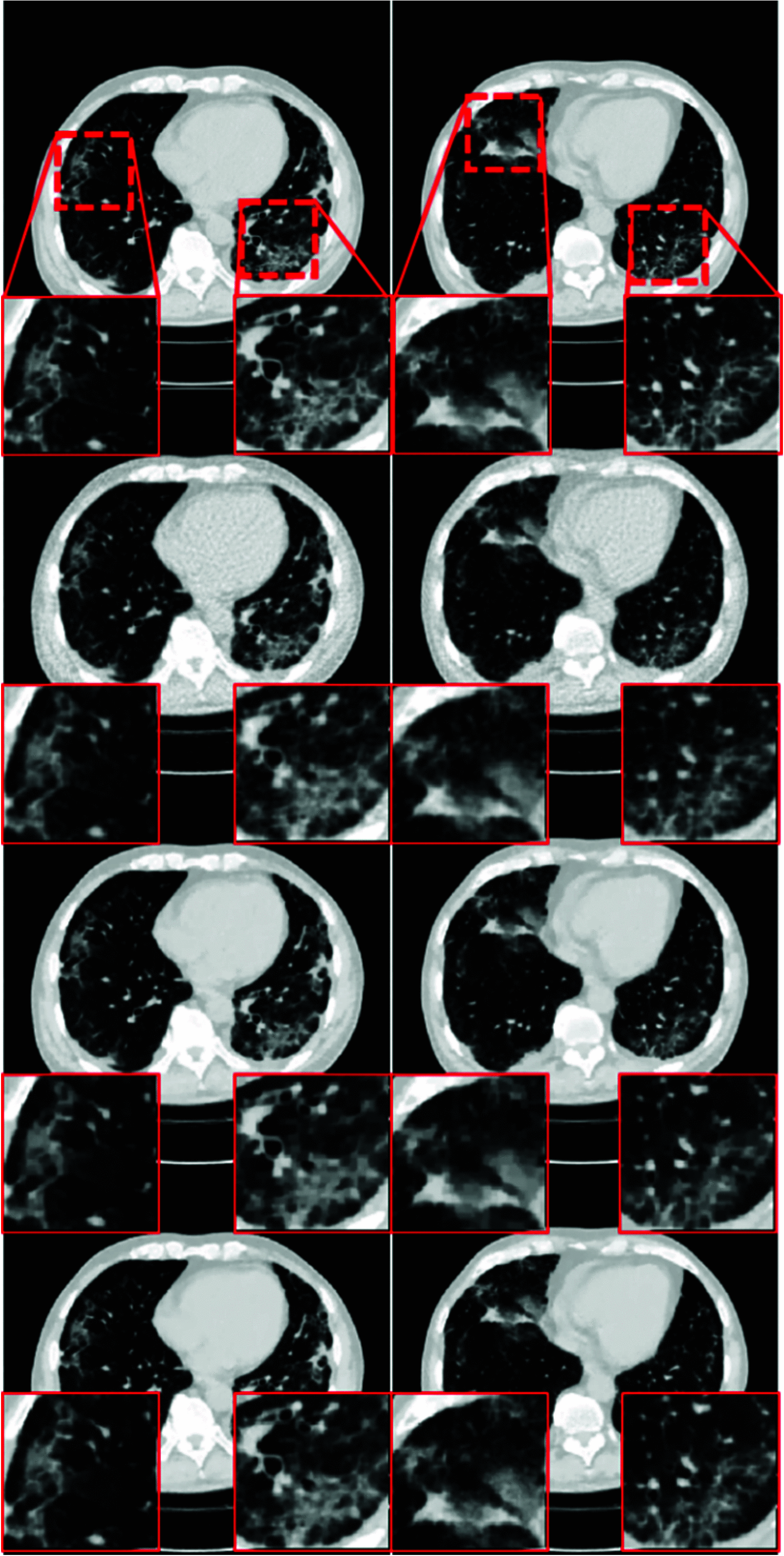 Fig. 14.