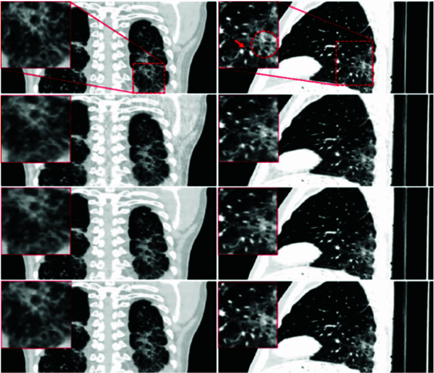 Fig. 16.