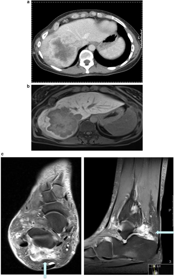 Fig. 1