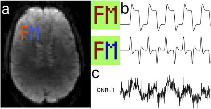 Fig. 2