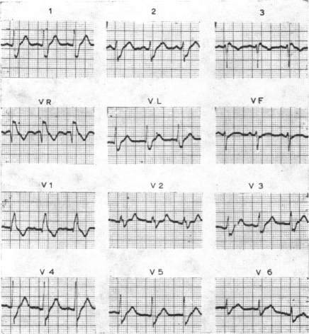 FIG. 6