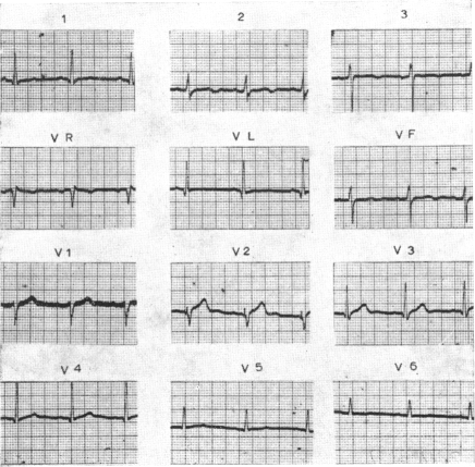 FIG. 7