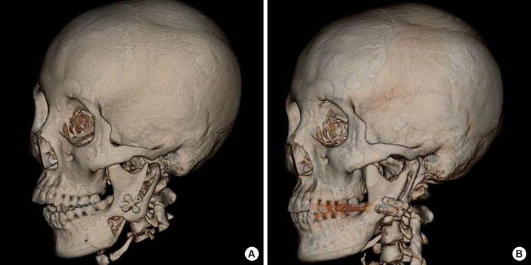 Fig. 8