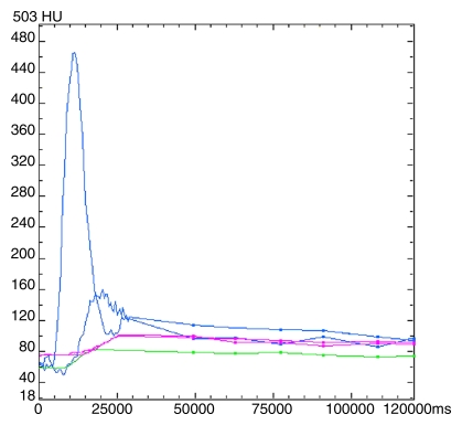 Figure 2a: