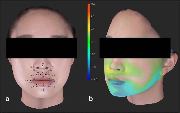 Fig. 1