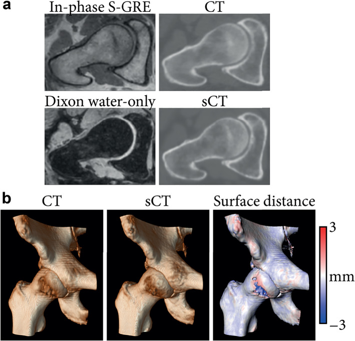 FIGURE 11