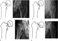Fig. 1A-D