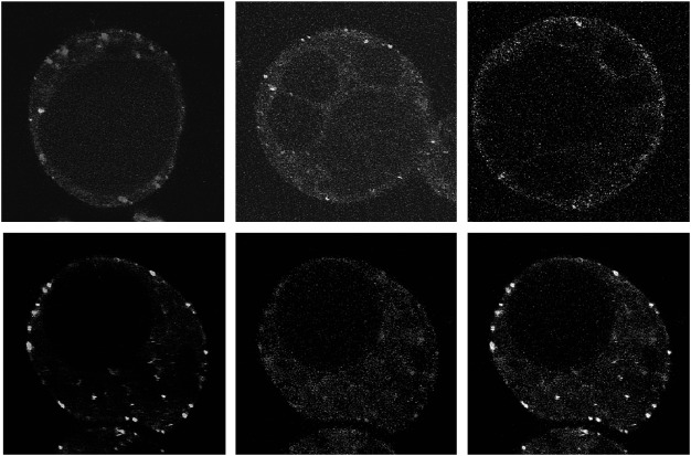 Figure 3. Subcellular localization of sGFP-tagged VAL1 (Green) and mRFP-tagged subcellular markers (Red) in Arabidopsis suspension cells. (A–C) Merged image of VAL1-sGFP and the Golgi body marker ST-mRFP (A), the TGN marker mRFP-SYP41 (B), and the endosome marker mRFP-ARA7 (C). (D–F) Localization of VAL1-sGFP (D), endosome marker mRFP-ARA6 (E), and a merged image of D and E (F). Arrows indicate the VAL1-sGFP stained organelles that were not marked by the endosome marker ARA6-sGFP. Scale bars: 5 µm.