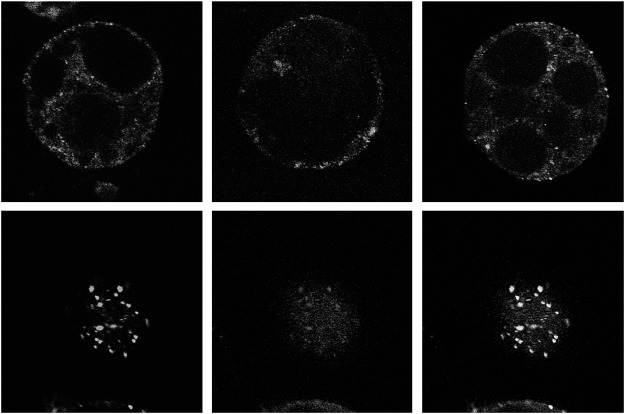 Figure 4. Subcellular localization of sGFP-tagged VAL2 (Green) and mRFP-tagged subcellular markers (Red) in Arabidopsis suspension cells. (A–C) Merged image of VAL2-sGFP and the Golgi body marker ST-mRFP (A), the TGN marker mRFP-SYP41 (B), and the endosome marker mRFP-ARA7 (C). (D–F) Localization of VAL2-sGFP (D), endosome marker mRFP-ARA6 (E), and a merged image of D and E (F). Arrows indicate the VAL2-sGFP stained organelles that were not marked by the endosome marker ARA6-sGFP. Scale bars: 5 µm.