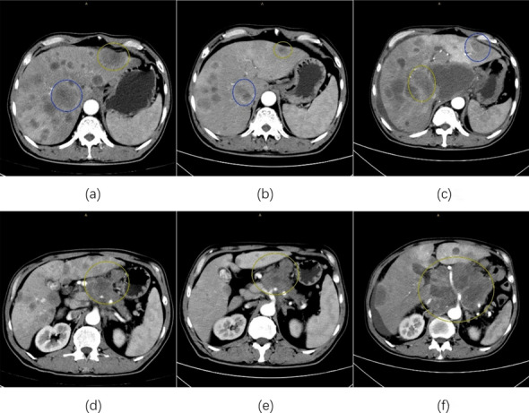 Fig. 1