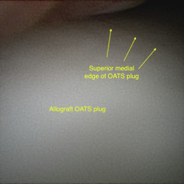 Fig 5
