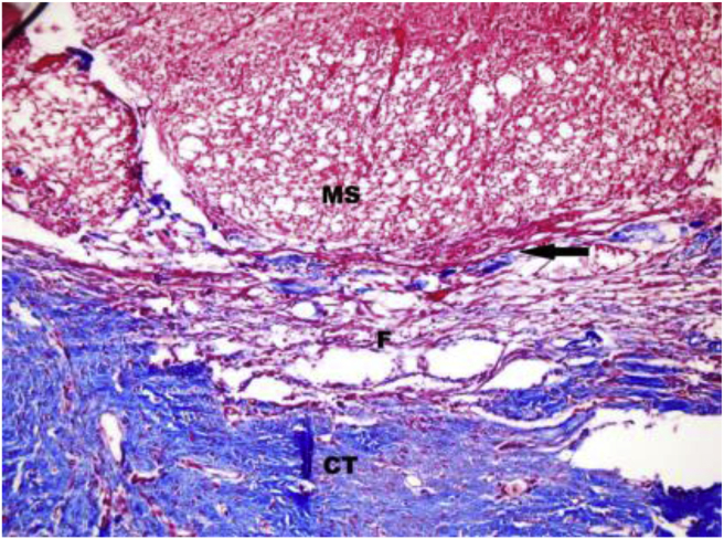 Fig. 2