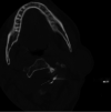 FIG 3.
